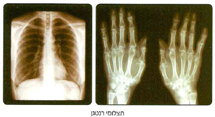 (בספר תמונה, היעזר במנחה)